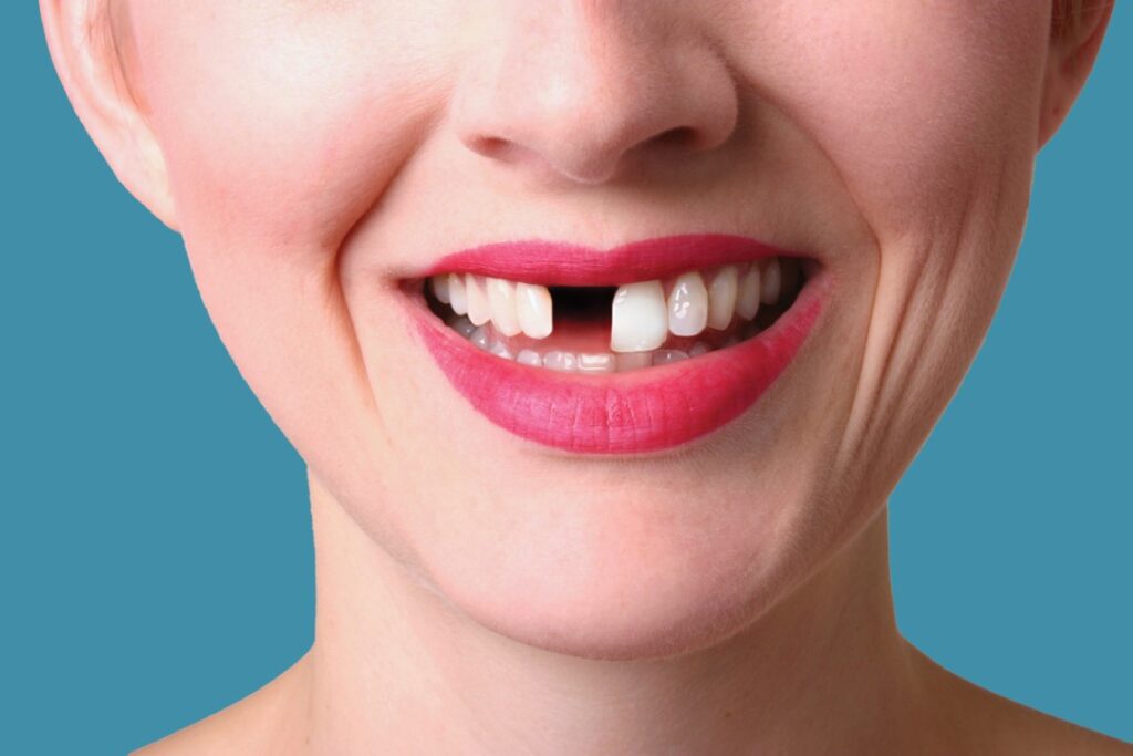 Teeth 2022